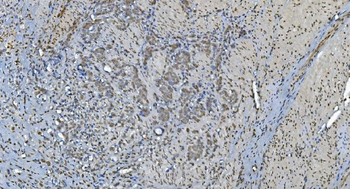 Anti-GRX2/GLRX2 Antibody