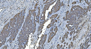 Anti-GRX2/GLRX2 Antibody