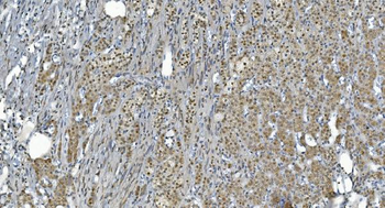 Anti-GRX2/GLRX2 Antibody