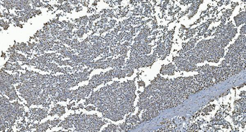Anti-GRX2/GLRX2 Antibody