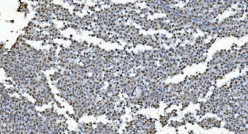 Anti-GRX2/GLRX2 Antibody