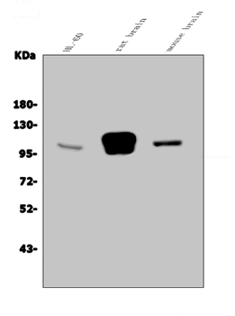 Anti-GRID2 Antibody