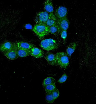 Anti-HYI Antibody