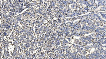 Anti-HYI Antibody