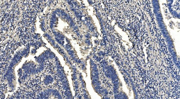 Anti-HYI Antibody