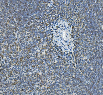 Anti-GILT/IFI30 Antibody