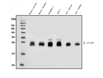Anti-GILT/IFI30 Antibody