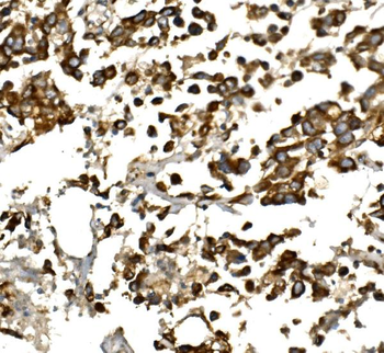 IGF1 Rabbit Polyclonal Antibody