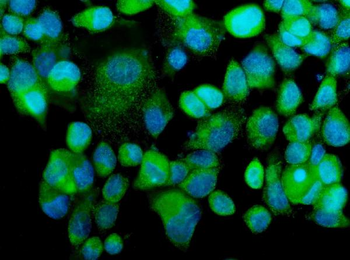 Anti-MEKK2/MAP3K2 Antibody
