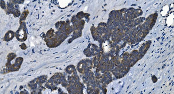 Anti-MAP4K5 Antibody