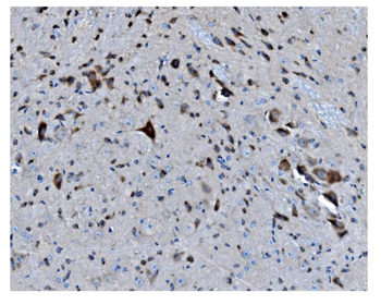 Anti-MAPK11 Antibody
