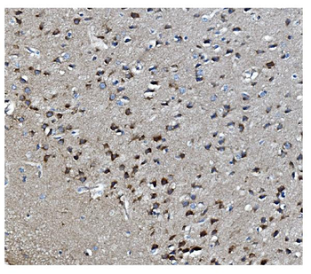Anti-MAPK11 Antibody