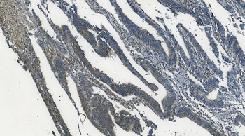 Anti-MAPK11 Antibody