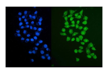 Anti-PARP2 Antibody
