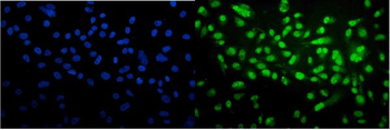 Anti-Cyclophilin E/PPIE Antibody