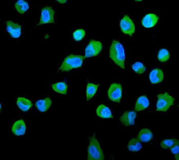 Anti-PSME2 Antibody