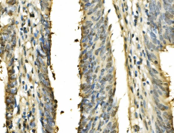 Anti-PSME2 Antibody