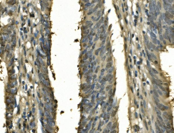 Anti-PSME2 Antibody