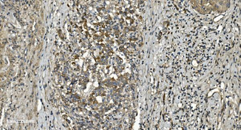 Anti-RGS6 Antibody
