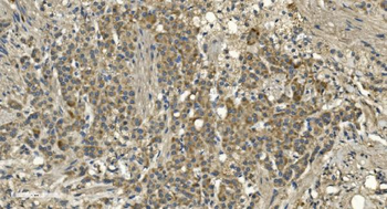 Anti-RGS6 Antibody