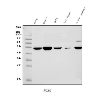 Anti-RGS6 Antibody