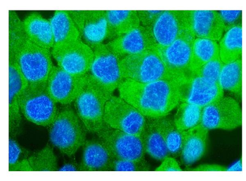 Anti-Sorbitol Dehydrogenase/SORD Antibody