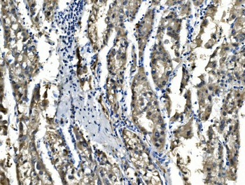 Anti-Sorbitol Dehydrogenase/SORD Antibody