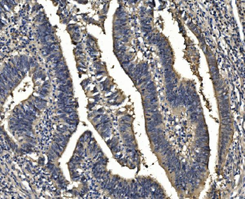 Anti-Sorbitol Dehydrogenase/SORD Antibody