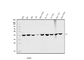 Anti-Sorbitol Dehydrogenase/SORD Antibody
