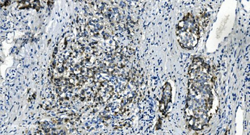 Anti-TMBIM1 Antibody