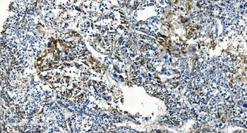 Anti-TMBIM1 Antibody