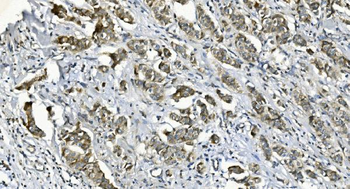 Anti-DGKZ/DGK-zeta Antibody