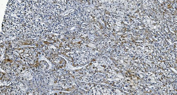 Anti-DGKZ/DGK-zeta Antibody