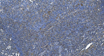Anti-DGKZ/DGK-zeta Antibody