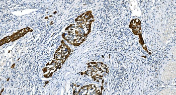 Anti-Glycine decarboxylase/GLDC Antibody