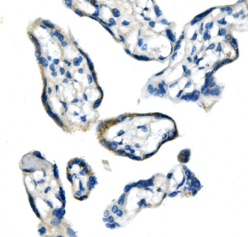Anti-Glycine decarboxylase/GLDC Antibody