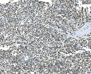 Anti-Glycine decarboxylase/GLDC Antibody