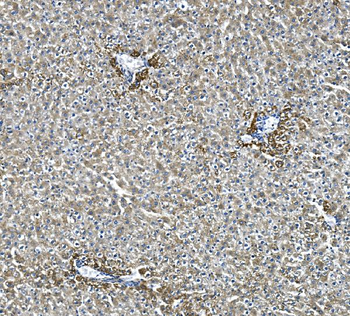 Glycine decarboxylase/GLDC Antibody