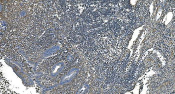 Anti-GNG2 Antibody