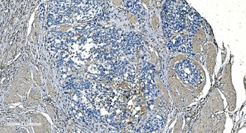 Anti-GNG2 Antibody
