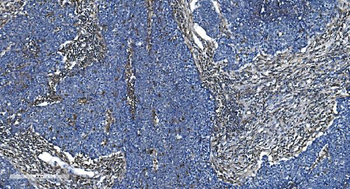 Anti-GNG2 Antibody