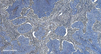 Anti-GNG2 Antibody