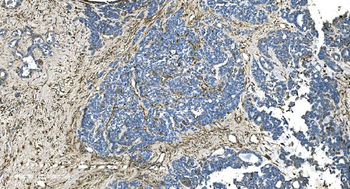 Anti-GNG2 Antibody