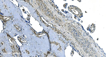 Anti-GNG2 Antibody