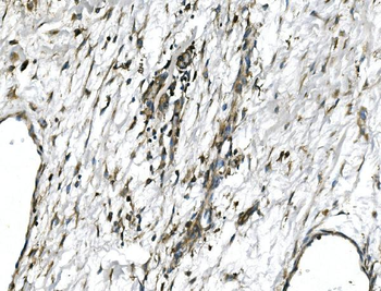 Anti-GNG4 Antibody