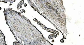 Anti-GNG4 Antibody