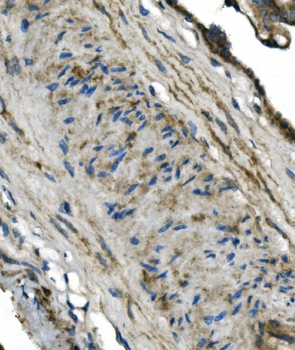 Anti-GNG4 Antibody