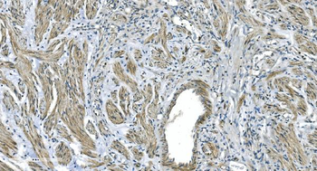 Anti-GNG4 Antibody