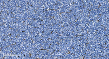 Anti-GNG11 Antibody