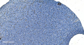 Anti-GNG11 Antibody